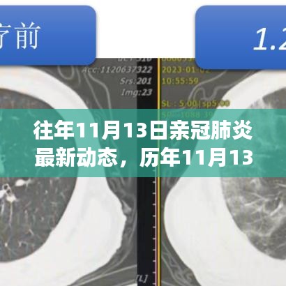 歷年11月13日新冠肺炎動態(tài)回顧，最新進展、當前動態(tài)與未來展望