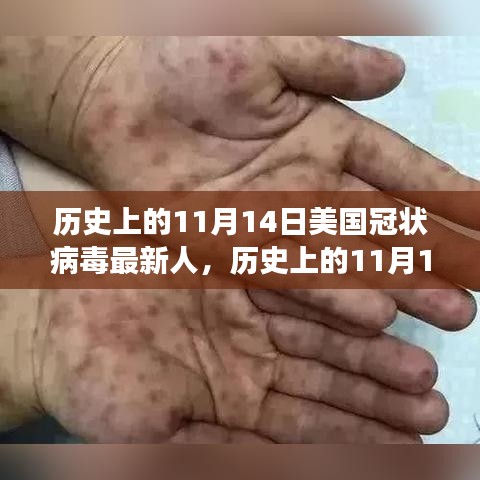 歷史上的11月14日，美國(guó)冠狀病毒最新進(jìn)展回顧與展望