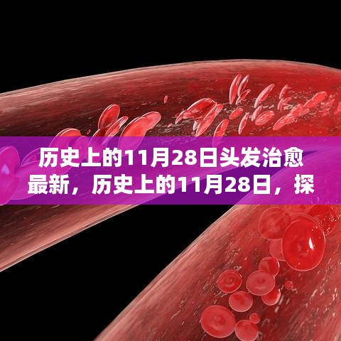 歷史上的11月28日，探尋頭發(fā)治愈的最新篇章??