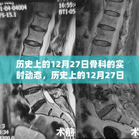 歷史上的骨科領域動態(tài)，聚焦十二月二十七日的實時進展概覽