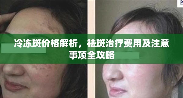 冷凍斑價格解析，祛斑治療費用及注意事項全攻略