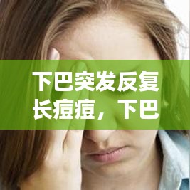 下巴突發(fā)反復(fù)長痘痘，下巴突發(fā)性長痘 