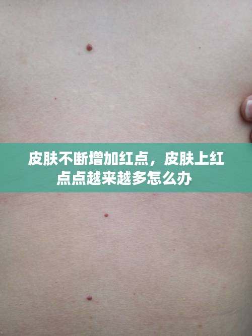 皮膚不斷增加紅點(diǎn)，皮膚上紅點(diǎn)點(diǎn)越來越多怎么辦 