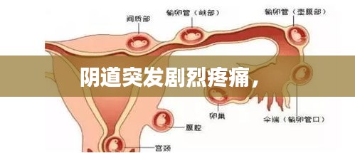 陰道突發(fā)劇烈疼痛， 