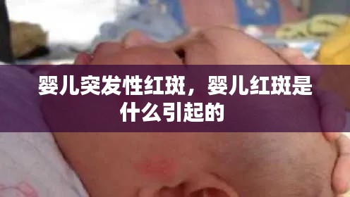 嬰兒突發(fā)性紅斑，嬰兒紅斑是什么引起的 